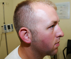 postracialcomments:  professoroaksparcel:  postracialcomments:  So this is Darren Wilson’s injuries? SERIOUSLY? THIS IS THE PROOF? IM DONE “Photo of Officer Darren Wilson released tonight as part of the evidence presented to the Ferguson grand jury