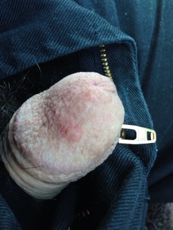 northbrisbaneboy:Zipped my dick in my fly!  Dried up cock head