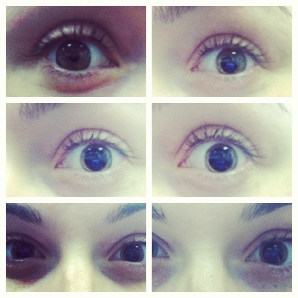 The process of eye dilation #picstitch #dialation #eyes #process #funny #blurry #bright