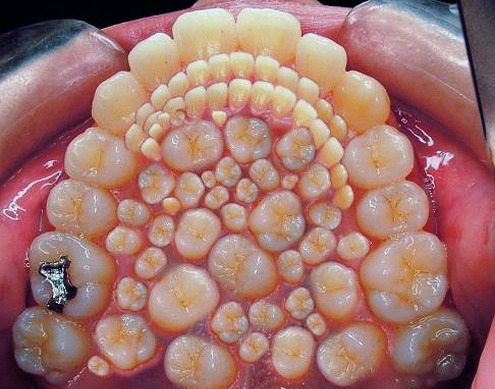 Teeth…and more teeth