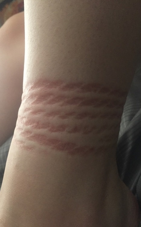 paintmewithbruises:  Rope marks are my favorite   🌿Don’t delete the caption🌿