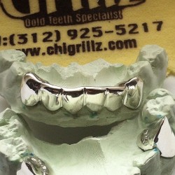 chigrillz-goldteeth:  #whitegold #grillz #mirror #fangs #custom #removable #goldteeth #grills #chigrillz