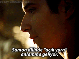 oadamburayagelecek:  açık bir yara gibi hissettiriyor.. 