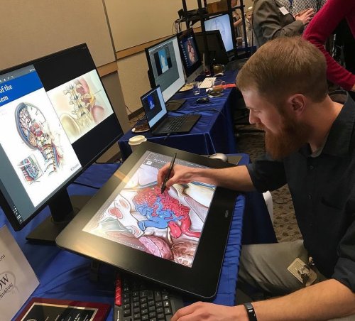 #throwback drawing an arteriovenous malformation (AVM) about three years ago as part of a Neuroscien