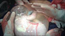 thatnigga-ian:  calmtempest:  startrekmademequeer:  lifeofabiologymajor:  artofseductionlxix:  mentalalchemy:    hoodjab: A Greek doctor has photographed an extremely rare moment during a birth, showing a baby still encased inside the amniotic sac after