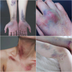 xxx tumblr