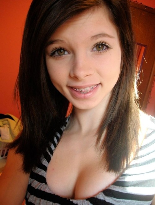 Cute teens with braces facial