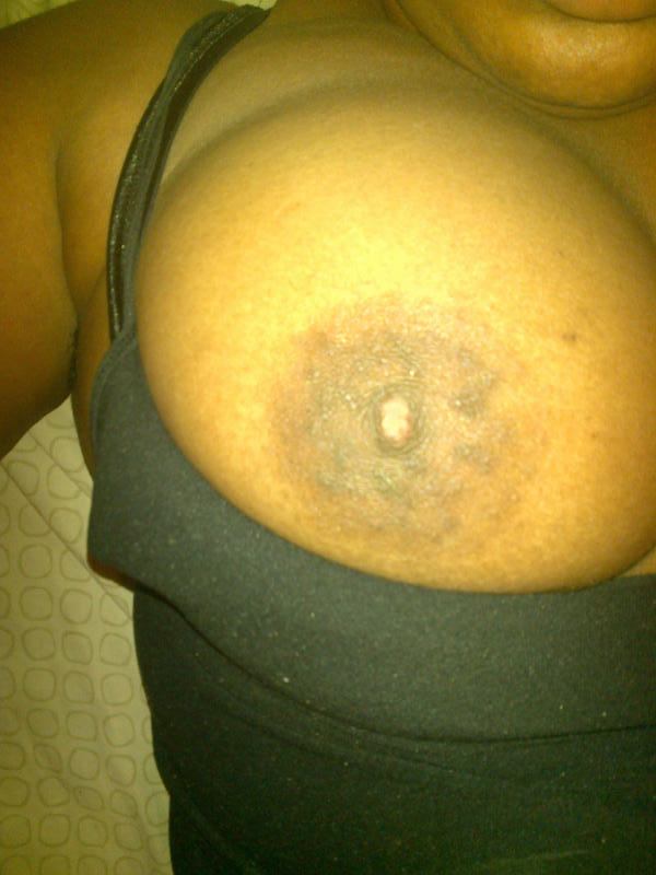 bbwsonly15:  BBW BREAST