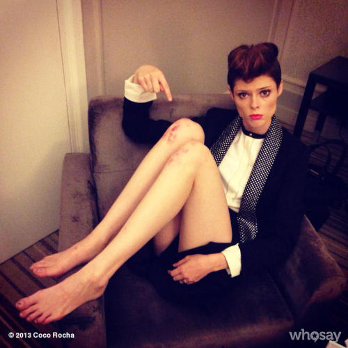 Look at my poor knees after rehearsing all day for Jean Paul Gaultier’s show today!
View more Coco Rocha on WhoSay