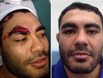 And that is why Rafael Natal&rsquo;s sparring partners will now be wearing knee pads.