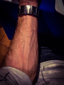 sexy-uredoinitright:  My arm does this thing