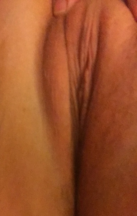 carefreehotwife: A little swollen lol Mmm let me kiss it make fill a lot better