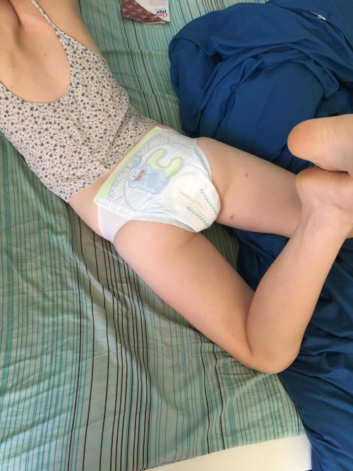 pale-pink-babydoll:The big bites on my butt are killing me