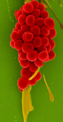 mucholderthen:  GRAPES OF WRATHStaphylococcus aureus colonyCourtesy of Prof. Dr. Rohde, HZI Braunschweig (via ZEISS Microscopy) S. aureusDomain: Bacteria  &gt;  Kingdom: Eubacteria  &gt;  Phylum: Firmicutes  ^^ my life at the moment, i really