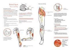 A usefull flyer about nerve damages’