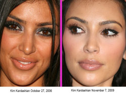 the-absolute-funniest-posts:  Check out Before and After cosmetic surgery pics right here! We think it works WONDERS! 