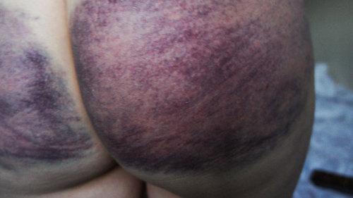 haunt-it: my ass, this color again please ….i do love a bruise. i love the colours.the first 