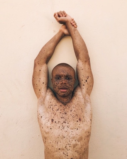 jourdepluie91:    It’s said a face without freckles is like a sky without stars 