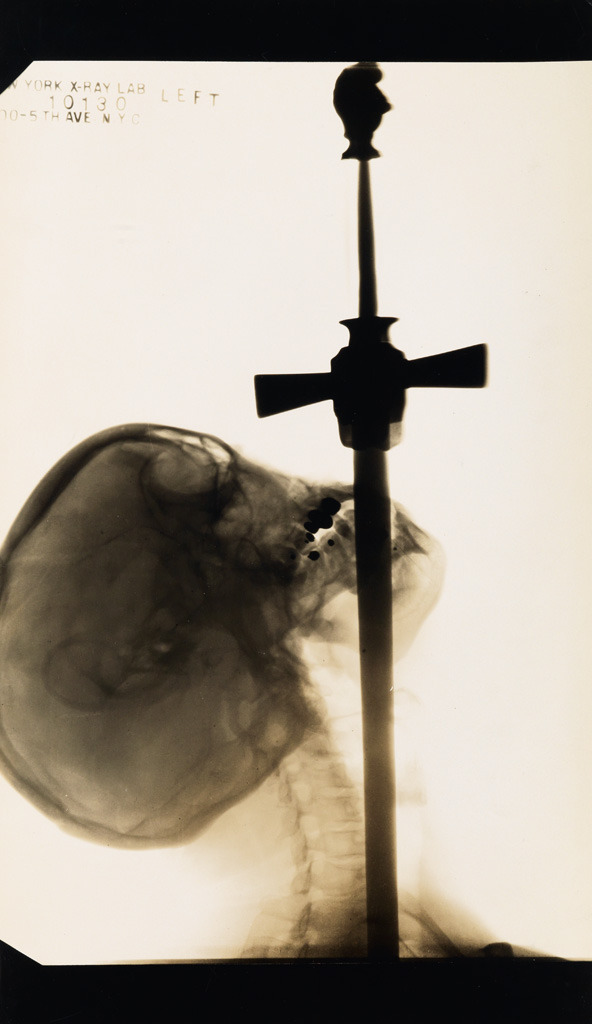 swanngalleries: EDWARD J KELTY X-ray of Ajax, the sword swallower. 1928 