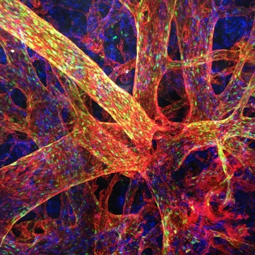 nysci:  Placental Vasculature of a transgenic mouse embryo. Want to see more beautiful and significa