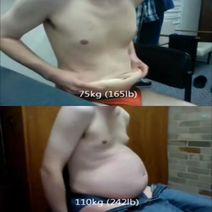 blogartus: admirer88888:  Dude apparently gained 110 pounds quite rapidly.  https://youtu.be/SgB0AySm-SU