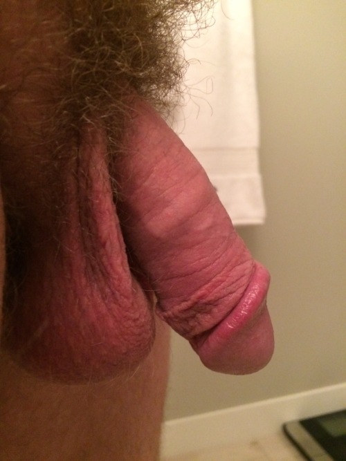 Week 47 #foreskinrestoration
