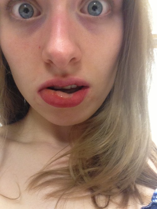 Selfie from this morning’s trip to the ER because narcissism