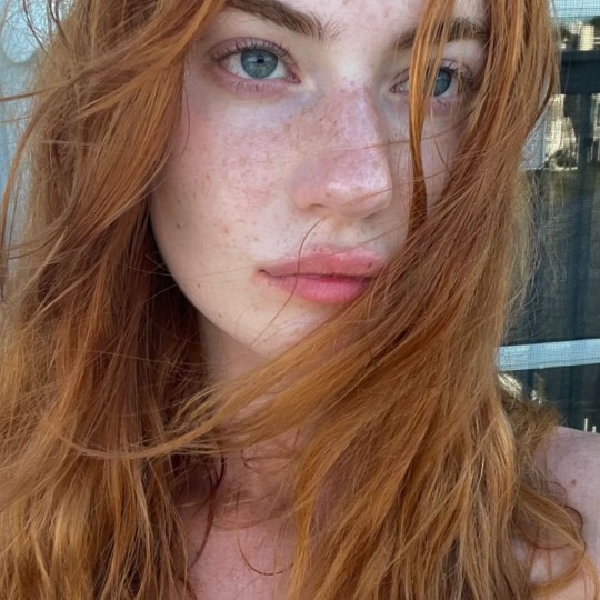 Freckled Girls Tumblr