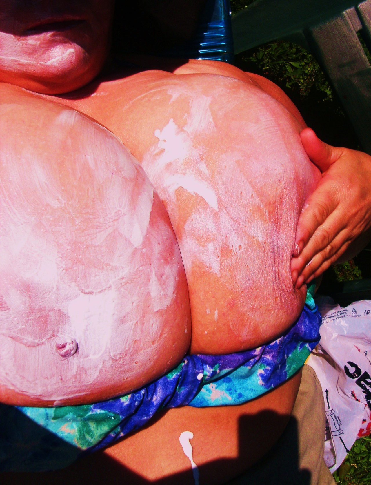 mylonelybreasts:  a past tanning day…they are few, becuz there is little sunshine