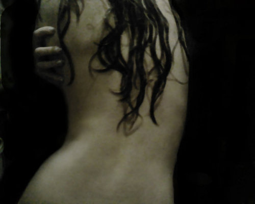 i bruise easily by shtrumphX