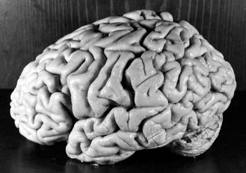 peashooter85:Dr. Thomas Harvey —- The Man Who Removed Einstein’s Brain,When on April 18th, 1955 the 