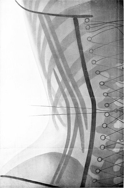lucysskeleton:Ludovic O’Followell’s, X-Ray illustrations for Le Corset (1908)Source