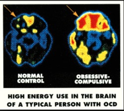 Living with OCD