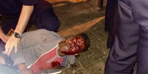 actionables:the information about Martese Johnson’s arrest broken down in tweets with picture evidence (video)Johnson was arrested on charges of resisting arrest, obstructing justice without threats of force, and profane swearing or intoxication in