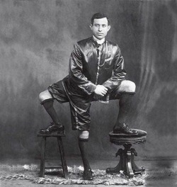 Frank Lentini, owner of 3 legs, 4 feet, 16