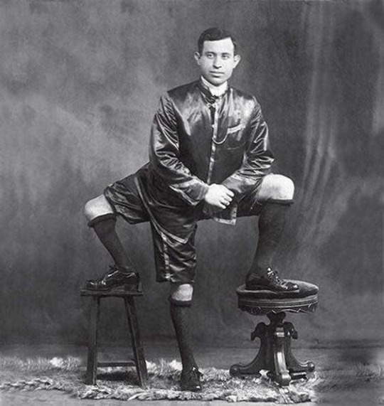 Frank Lentini, owner of 3 legs, 4 feet, 16 toes, and 2 functioning sets of genitals (1884-1966)