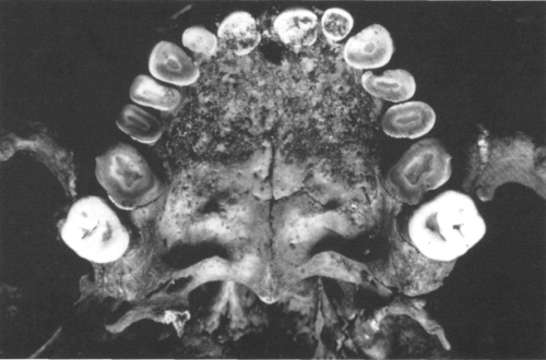 Porn Pics anthropologyadventures:  Dental Anthropology