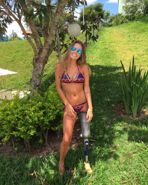 interdevo-devotee:disablebeauty:the love of my lifePaola Antonini prosthetic leg photoset