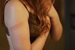 erotic-nonfiction: Rope burn Pretty rope marks by @kbnawa, photos by @chien-espagnol 
