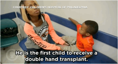 huffingtonpost:  WATCH: Boy, 8, Is First Child Ever To Receive Double Hand Transplant“Never
