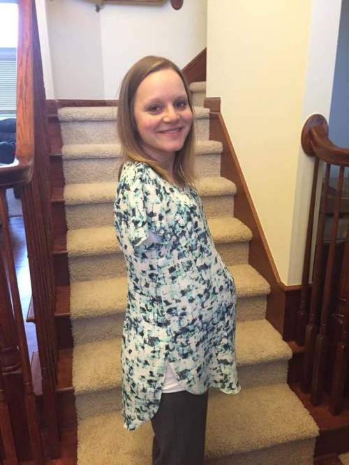 absencedevotion: A beautiful armless lady ❤ Beautiful Jessica