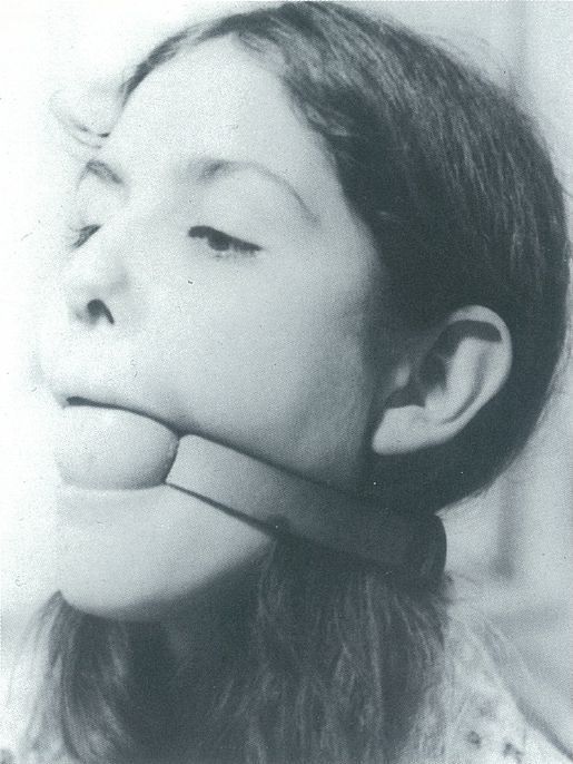 Mouthlock