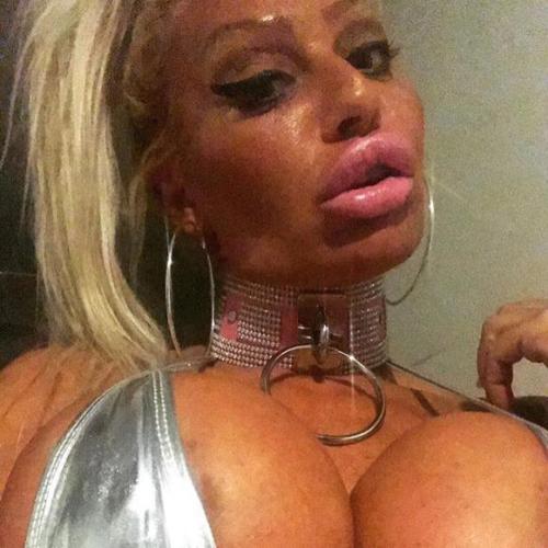 XXX Lover of extreme fake and huge boobs, lips, photo