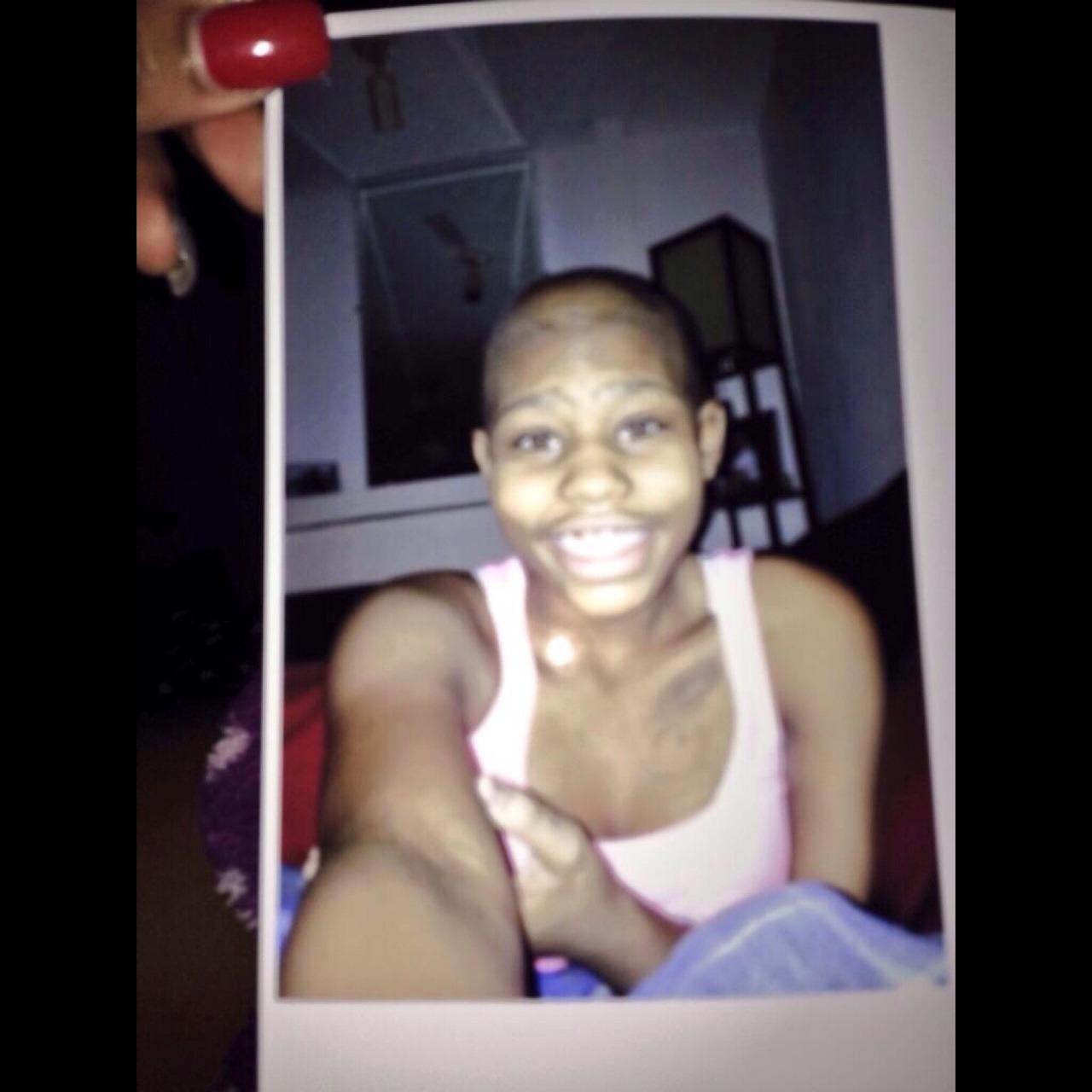 kushandwizdom:  chiraq400:simplyyjazmyn:  2 years ago til now. Cancer free ✊😊
