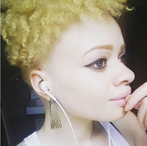 invisiblemelanin:Black people with albinism are strong and beautiful, don’t deny our heritage.