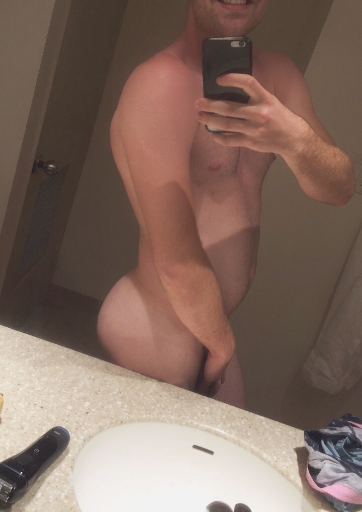 iampuer:  Burned beach bum 
