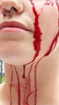 that-devil-just-smiled:  bruisedmmmmuse:  ch0kewh0re:  The aftermath of face needles.  Gorgeous! 😍  Great shot.  