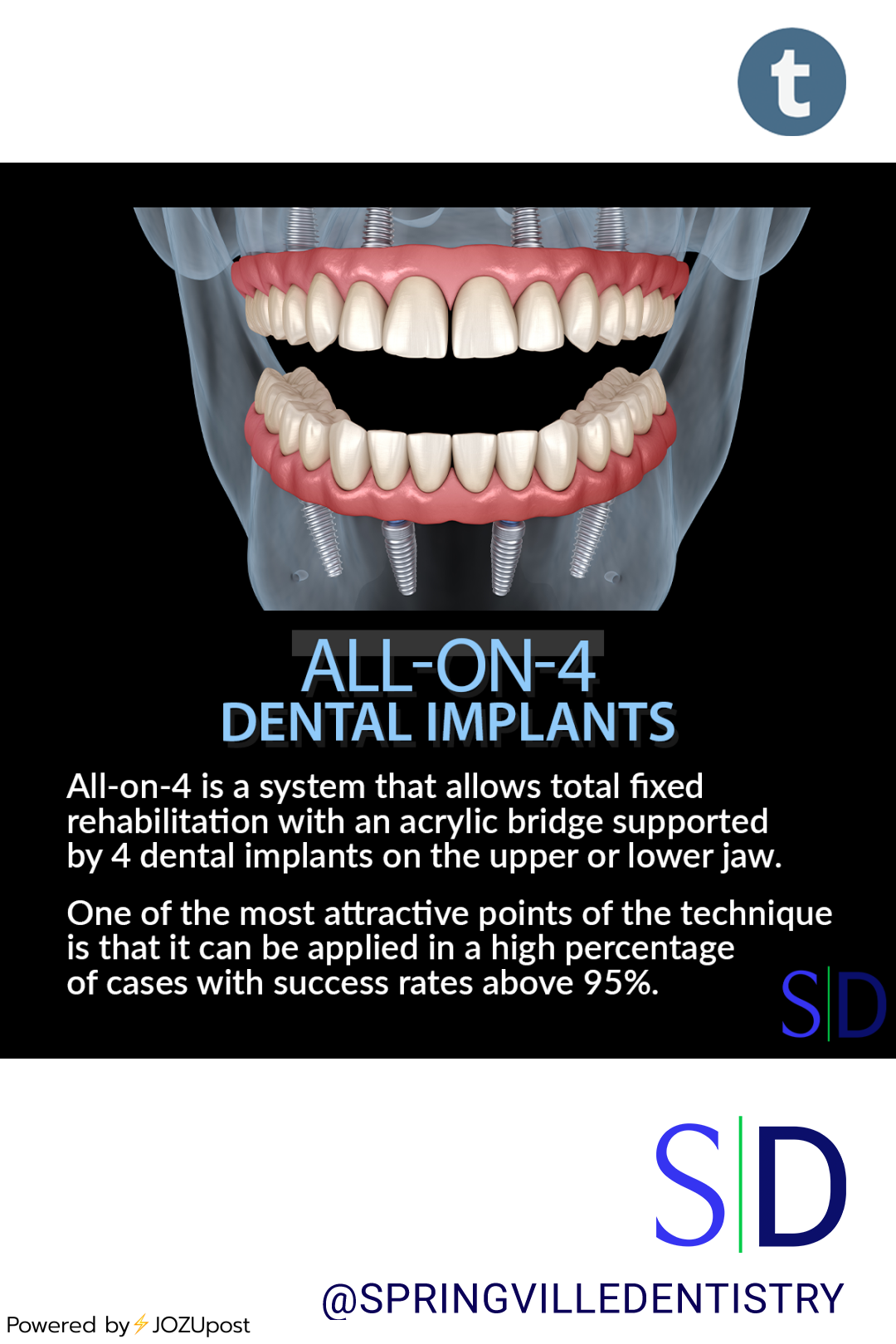 Smile Transformation with All-on-4® are quick, efficient, and do not rely on bone grafts.
The All-on-4® treatment concept is a cost-efficient dental solution that offers patients a fixed full-mouth solution on the day of surgery. This innovative...