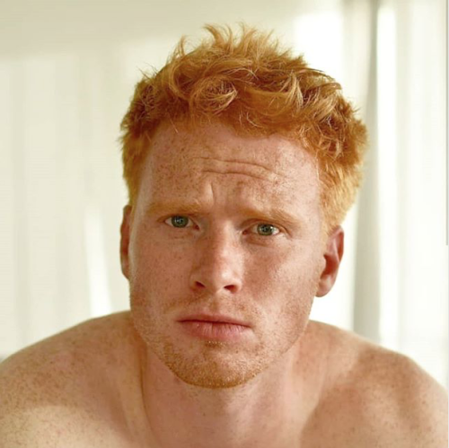 redgingerweakness: ginger-genes: @benkoomen Submit Your Ginger - redgingerweakness.tumblr.com