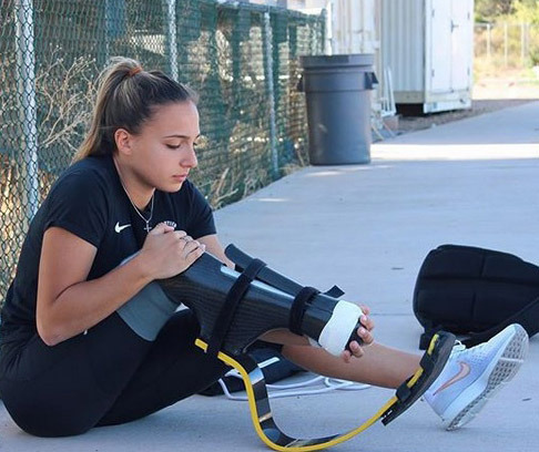 Marissa Paps para athlete putting on her BK prosthetic blade.